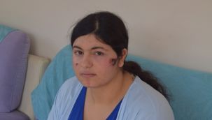 EŞİNDEN ŞİDDET GÖREN KADIN KONUŞTU