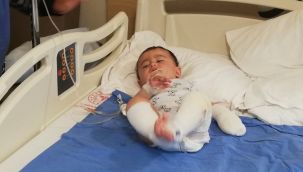 10 aylık bebeğin üzerine kaynar su döküldü