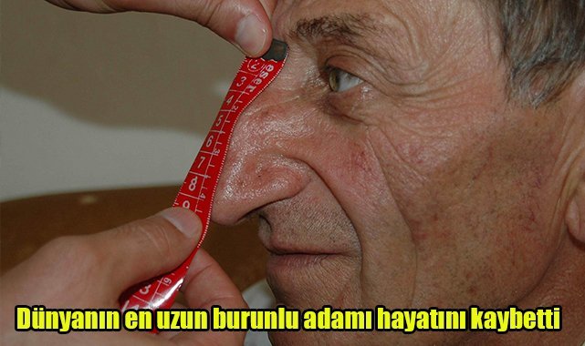 Dünyanın en uzun burunlu adamı hayatını kaybetti