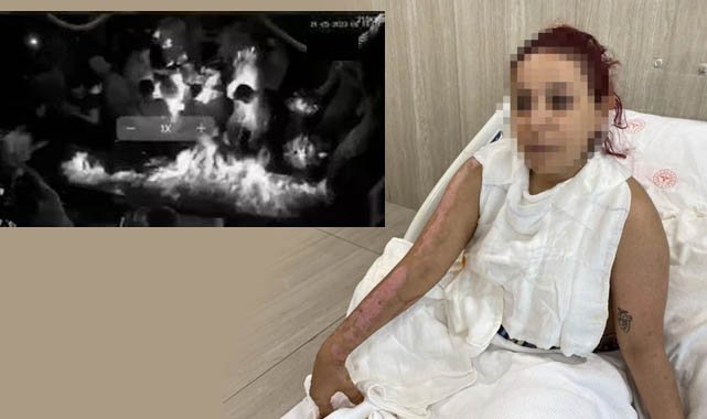 Barda yanan genç kız dehşet anlarını anlattı