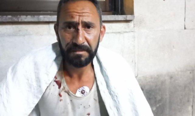 Kuvvetli fırtına çatıda çalışan 5 işçiyi savurdu
