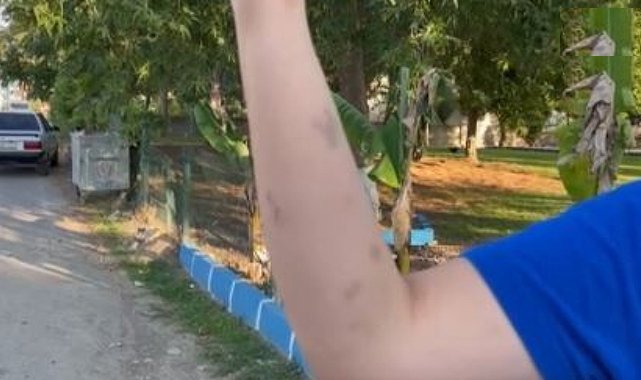 Yolda yürüyen genç kızlara dehşeti yaşattılar
