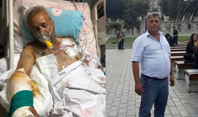 Eski muhtarın vurduğu ağabeyine, 300'e yakın saçma isabet etti