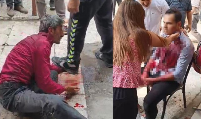 Kızıyla ilişki iddiasıyla dövüp, bıçakla boğazından yaraladı