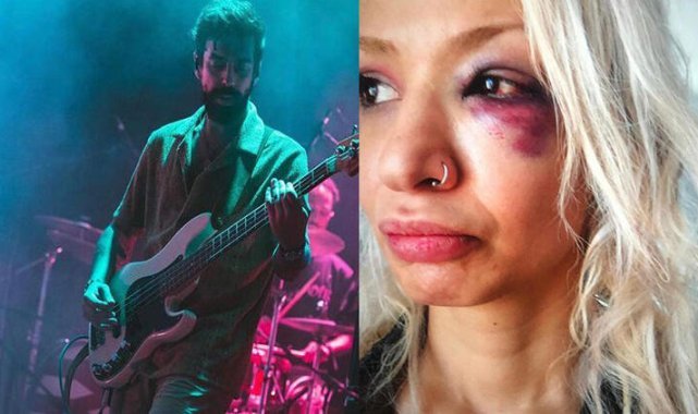 Yüzyüzeyken Konuşuruz'un gitaristine sevgilisini darbettiği iddiasıyla soruşturma