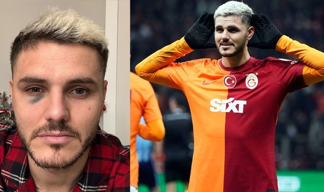 Galatasaray'da Icardi şoku