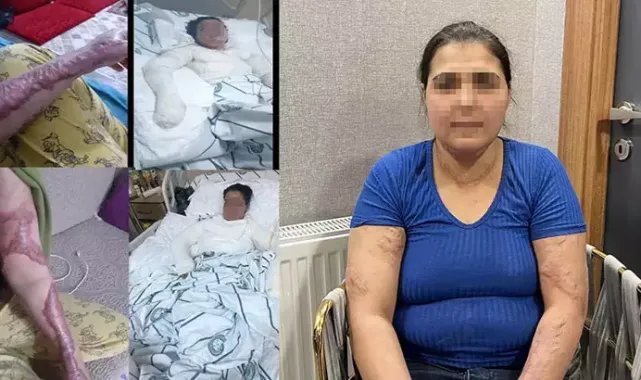 Eşinin ve kayınbiraderinin sıcak ütü basıp, kolonyayla yakmaya çalıştığı Yazgül; Beni öldürecekler