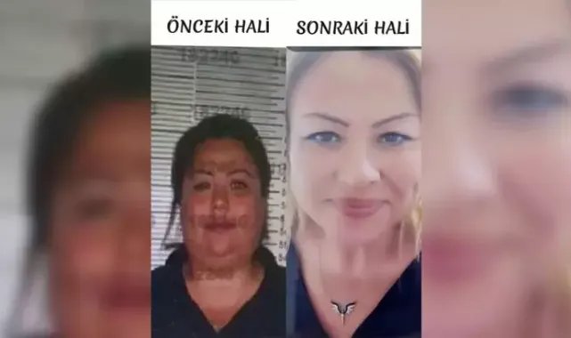 Kimliğini kullandığı kardeşine benzemek için estetik yaptıran şüpheliyi jandarma yakaladı