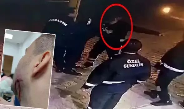 Tekirdağ'da, jandarma personelinin tartıştığı sağlıkçıyı ısırdı