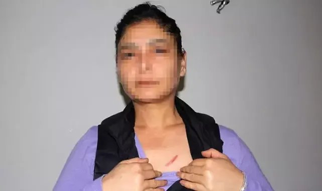 Daha önce evinin kapısını yaktığı kadını, elektrikli düzenekle öldürmeye çalıştı