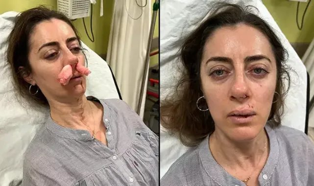 Kendisini eşinin sevgilisi zanneden kadın tarafından darbedildi