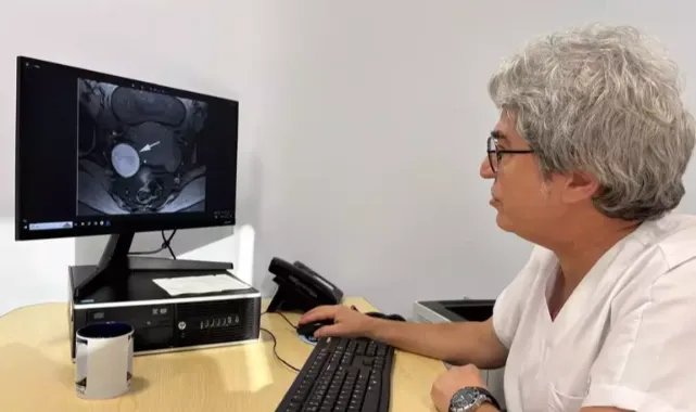 ‘Çikolata kisti olarak bilinen endometrioziste gizli tehlike; eşlik eden hastalıklar’