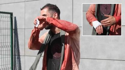 "13 dakikada kurbanı keserim" diyen acemi kasap kendni kesti