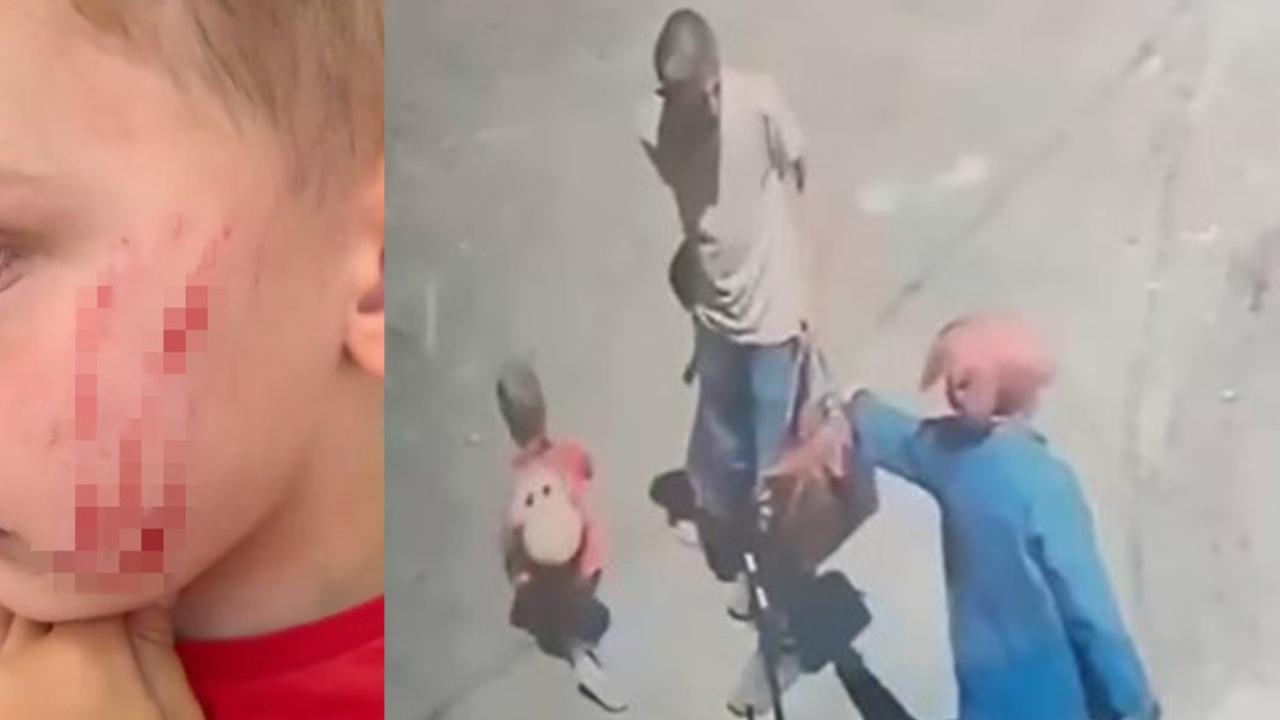 Van’da sokakta oynayan çocuğa saldırı